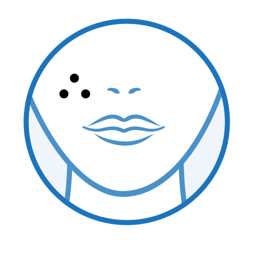 できもの・いぼ・ほくろ