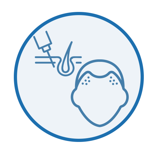 髪の毛の悩み（脱毛症・薄毛）