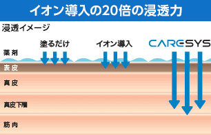 イオン導入の20倍の浸透力