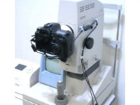 眼底カメラ