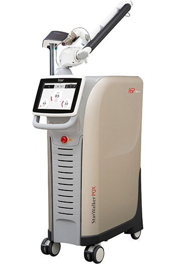 QスイッチYAGレーザー